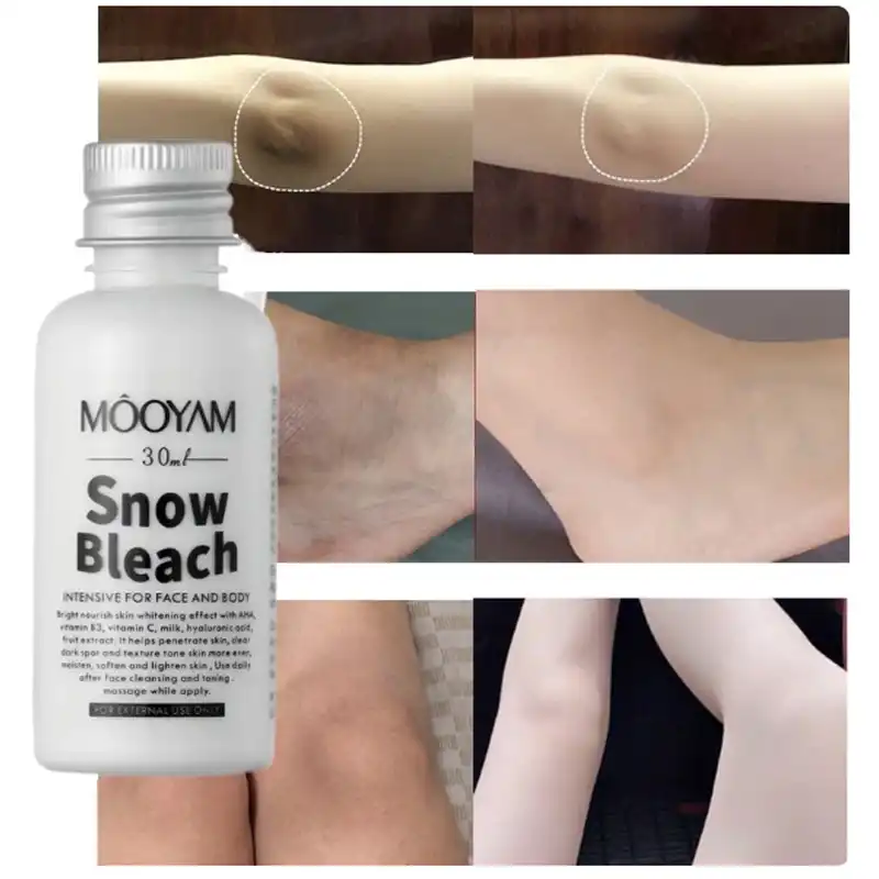 کرم سفید کننده دائمی بیکینی و بدن مویام MOOYAM حجم 30 میل اصلی