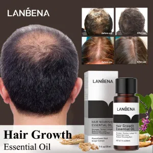 روغن تقویت و رشد مو لانبنا مناسب ضد ریزش مو و ضخیم کننده تارهای مو کد 0380